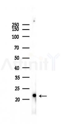Ferritin Light Chain Recombinant Rabbit mAb - Western blot analysis of lysates from B16F10-LUC cells(LPS,4h treatment), using Ferritin Light Chain Rabbit mAb at 1/1000 dilution.