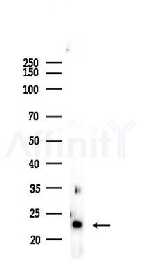 Ferritin Light Chain Recombinant Rabbit mAb - Western blot analysis of lysates from Rat testis, using Ferritin Light Chain Rabbit mAb at 1/1000 dilution.