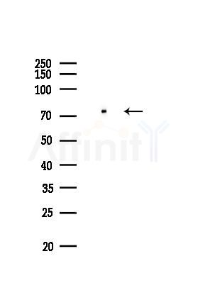 METTL3 Recombinant Rabbit mAb - Western blot analysis of lysates from EC304 cells(LPS,4h treatment), using METTL3 Rabbit mAb at 1/1000 dilution.