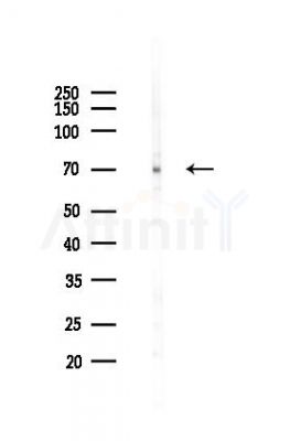 METTL3 Recombinant Rabbit mAb - Western blot analysis of lysates from A375 cells(heat-shock,45min treatment), using METTL3 Rabbit mAb at 1/1000 dilution.