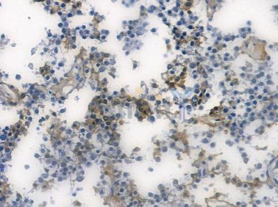 METTL3 Recombinant Rabbit mAb - BF3332 at 1/100 staining human pituitary adenoma by IHC-P.