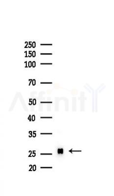Myelin Basic Protein/MBP Recombinant Rabbit mAb - Western blot analysis of lysates from Rat liver, using Myelin Basic Protein Recombinant Rabbit mAb at 1/1000 dilution.