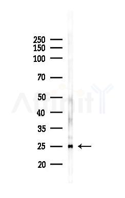 Myelin Basic Protein/MBP Recombinant Rabbit mAb - Western blot analysis of lysates from B16F10-LUC cells(LPS 4h treatment), using Myelin Basic Protein Recombinant Rabbit mAb at 1/1000 dilution.