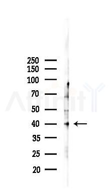 DUSP1/MKP1 Recombinant Rabbit mAb - Western blot analysis of lysates from B16F10-LUC cells(starvation,24h treatment), using DUSP1 Recombinant Rabbit mAb at 1/1000 dilution.