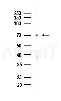 TAK1 Recombinant Rabbit mAb - Western blot analysis of lysates from COLO205 cells(heat-shock, 45min treatment), using TAK1 Recombinant Rabbit mAb at 1/1000 dilution.