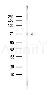 TAK1 Recombinant Rabbit mAb - Western blot analysis of lysates from Rat brain, using TAK1 Recombinant Rabbit mAb at 1/1000 dilution.