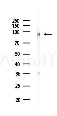 Integrin beta3 Recombinant Rabbit mAb - Western blot analysis of lysates from Hela cells(LPS,4h treatment), using Integrin beta 3 Recombinant Rabbit mAb at 1/1000 dilution.
