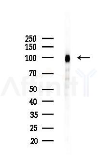 Integrin beta3 Recombinant Rabbit mAb - Western blot analysis of lysates from HUVEC cells(LPS,4h treatment), using Integrin beta 3 Recombinant Rabbit mAb at 1/1000 dilution.