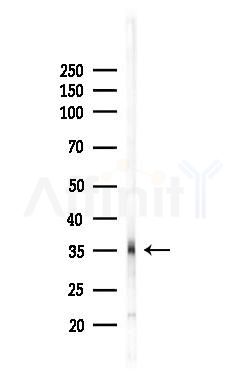 CTGF Recombinant Rabbit mAb - Western blot analysis of lysates from Rat kidney, using CTGF Recombinant Rabbit mAb at 1/1000 dilution.
