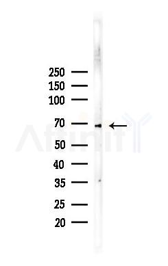 HGF Recombinant Rabbit mAb - Western blot analysis of lysates from COLO205 cells(heat-shock,45min treatment), using HGF Recombinant Rabbit mAb at 1/1000 dilution.