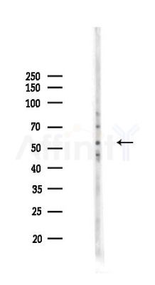 IRF5 Recombinant Rabbit mAb - Western blot analysis of lysates from COLO205 cells(LPS,4h treatment), using IRF5 Recombinant Rabbit mAb at 1/1000 dilution.