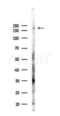 Dnmt1 Recombinant Rabbit mAb - Western blot analysis of lysates from Hela cells(LPS,4h treatment), using Dnmt1 Recombinant Rabbit mAb at 1/1000 dilution.