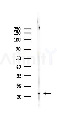 FGF21 Recombinant Rabbit mAb - Western blot analysis of lysates from Rat spleen, using FGF21 Recombinant Rabbit mAb at 1/1000 dilution.