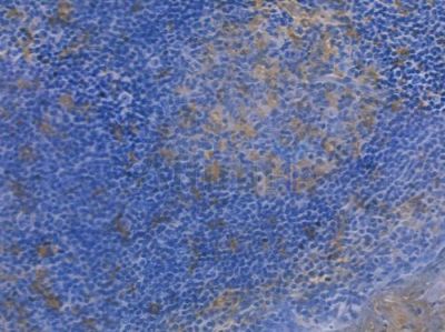 FGF21 Recombinant Rabbit mAb - BF3354 at 1/100 staining human normal tonsil tissue by IHC-P.