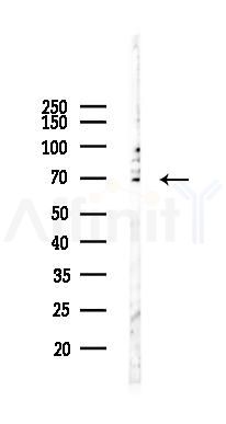 NUR77 Recombinant Rabbit mAb - Western blot analysis of lysates from EC304 cells(LPS, 4h treatment), using NUR77 Recombinant Rabbit mAb at 1/1000 dilution.