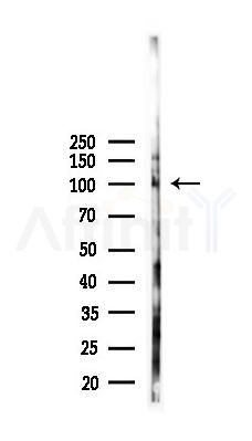 NMDAR1 Recombinant Rabbit mAb - Western blot analysis of lysates from B16F10-LUC cells(starvation,24h treatment), using NMDAR1 Recombinant Rabbit mAb at 1/1000 dilution.