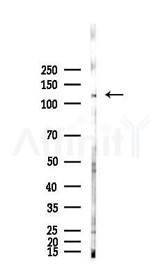 Phospho-NMDAR1 (Ser889) Recombinant Rabbit mAb - Western blot analysis of lysates from Mouse lung, using Phospho-NMDAR1 (Ser889) Recombinant Rabbit mAb at 1/1000 dilution.