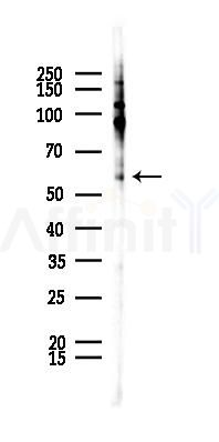 MST1/STK4 Recombinant Rabbit mAb - Western blot analysis of lysates from LoVo cells(heat-shock,45min treatment), using Serine/threonine-protein kinase 4 Recombinant Rabbit mAb at 1/1000 dilution.