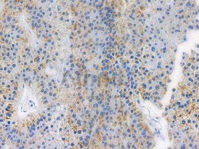 MST1/STK4 Recombinant Rabbit mAb - BF3360 at 1/100 staining human normal liver tissue by IHC-P.