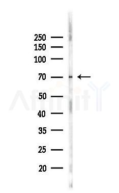 ATG7 Recombinant Rabbit mAb - Western blot analysis of lysates from Hela cells(heat-shock,45min treatment), using ATG7 Recombinant Rabbit mAb at 1/1000 dilution.