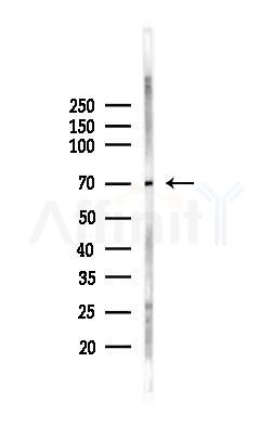 ATG7 Recombinant Rabbit mAb - Western blot analysis of lysates from B16F10-LUC cells(starvation,24h treatment), using ATG7 Recombinant Rabbit mAb at 1/1000 dilution.