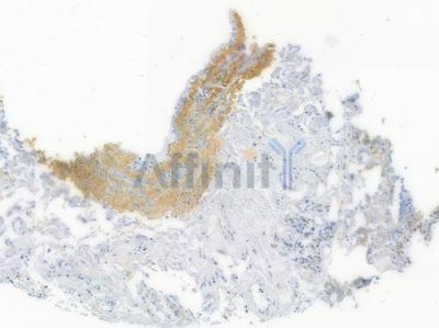 LAMP2 Recombinant Rabbit mAb - BF3362 at 1/100 staining human normal lung tissue by IHC-P.