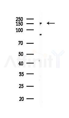 Brd4 Recombinant Rabbit mAb - Western blot analysis of lysates from A375 cells(heat-shock,45min treatment), using Brd4 Recombinant Rabbit mAb at 1/1000 dilution.