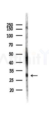 Phospho-CDK2 (Tyr15) Recombinant Rabbit mAb - Western blot analysis of lysates from HepG2 cells(heat-shock,45min treatment), using Phospho-CDK2 (Tyr15) Rabbit mAb at 1/1000 dilution.