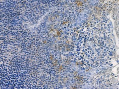 Phospho-CDK2 (Tyr15) Recombinant Rabbit mAb - BF3365 at 1/100 staining human normal tonsil tissue by IHC-P.