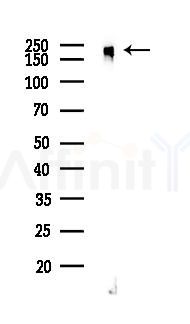 MERTK Recombinant Rabbit mAb - Western blot analysis of lysates from EC304 cells(LPS, 4h treatment), using MERTK Recombinant Rabbit mAb at 1/1000 dilution.