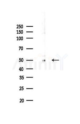 Vitamin D Receptor Recombinant Rabbit mAb - Western blot analysis of lysates from Hela cells(LPS,4h treatment), using Vitamin D Receptor Recombinant Rabbit mAb at 1/1000 dilution.