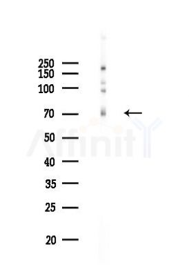 Phospho-C-RAF (Ser259) Recombinant Rabbit mAb - Western blot analysis of lysates from EC304 cells(LPS,4h treatment), using Phospho-Raf1 (Ser259) Rabbit mAb at 1/1000 dilution.