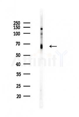 Phospho-C-RAF (Ser259) Recombinant Rabbit mAb - Western blot analysis of lysates from A375 cells(heat-shock,45min treatment), using Phospho-Raf1 (Ser259) Rabbit mAb at 1/1000 dilution.