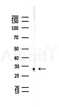 Phospho-CDK1/CDC2 (Thr14) Recombinant Rabbit mAb - Western blot analysis of lysates from LoVo cells(heat-shock,45min treatment), using Phospho-CDK1/2 (Thr14) Recombinant Rabbit mAb at 1/1000 dilution.