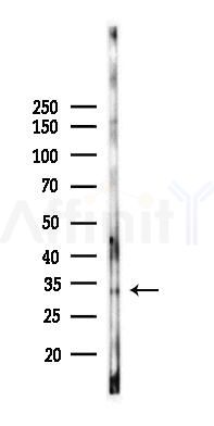Phospho-CDK1/CDC2 (Thr14) Recombinant Rabbit mAb - Western blot analysis of lysates from B16F10-LUC cells(heat-shock,45min treatment), using Phospho-CDK1/2 (Thr14) Recombinant Rabbit mAb at 1/1000 dilution.