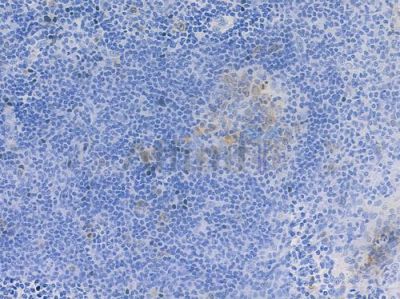 Phospho-CDK1/CDC2 (Thr14) Recombinant Rabbit mAb - BF3375 at 1/100 staining human normal tonsil tissue by IHC-P.