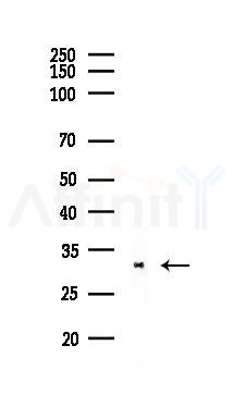 CDK1/CDC2 Recombinant Rabbit mAb - Western blot analysis of lysates from A375 cells(heat-shock,45min treatment), using CDK1 Recombinant Rabbit mAb at 1/1000 dilution.