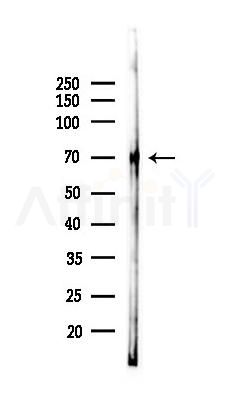 MSR1 Recombinant Rabbit mAb - Western blot analysis of lysates from Rat lung, using CD204 Recombinant Rabbit mAb at 1/1000 dilution.