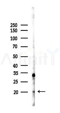 Cofilin Recombinant Rabbit mAb - Western blot analysis of lysates from B16F10-LUC cells(heat-shock,45min treatment), using Cofilin Recombinant Rabbit mAb at 1/1000 dilution.