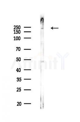 GCN2 Recombinant Rabbit mAb - Western blot analysis of lysates from EC304 cells(LPS,4h treatment), using GCN2 Rabbit mAb at 1/1000 dilution.
