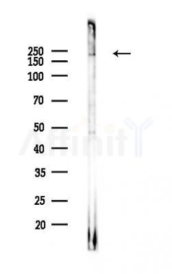 GCN2 Recombinant Rabbit mAb - Western blot analysis of lysates from A375 cells(heat-shock,45min treatment), using GCN2 Rabbit mAb at 1/1000 dilution.