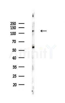 Progesterone Receptor Recombinant Rabbit mAb - Western blot analysis of lysates from Mouse liver, using Progesterone Receptor Recombinant Rabbit mAb at 1/1000 dilution.