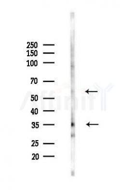 LYVE1 Recombinant Rabbit mAb - Western blot analysis of lysates from Rat testis, using LYVE1 Recombinant Rabbit mAb at 1/1000 dilution.