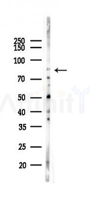 Hsp90 alpha Recombinant Rabbit mAb - Western blot analysis of lysates from A2780 cells(LPS 4h treatment), using Hsp90 Recombinant Rabbit mAb at 1/1000 dilution.
