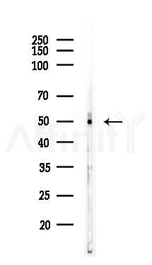 TXNIP Recombinant Rabbit mAb - Western blot analysis of lysates from A375 cells(heat-shock,45min treatment), using TXNIP Recombinant Rabbit mAb at 1/1000 dilution.