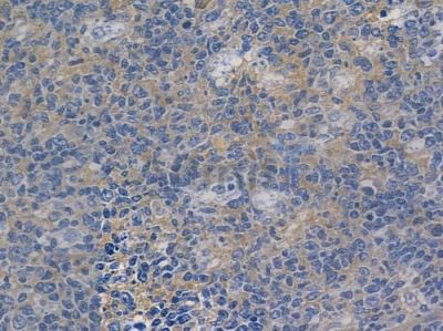 TXNIP Recombinant Rabbit mAb - BF3390 at 1/100 staining human normal tonsil tissue by IHC-P.