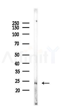 Phospho-Caveolin 1 (Tyr14) Recombinant Rabbit mAb - Western blot analysis of lysates from Rat kidney, using Phospho-Caveolin-1 (Tyr14) Recombinant Rabbit mAb at 1/1000 dilution.