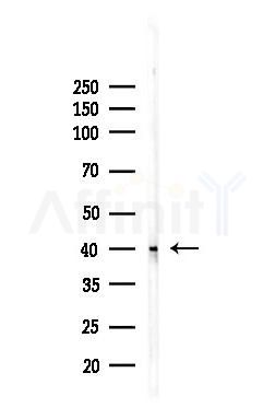TDP43 Recombinant Rabbit mAb - Western blot analysis of lysates from Rat kidney, using TDP43 Recombinant Rabbit mAb at 1/1000 dilution.