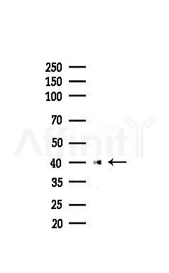 TDP43 Recombinant Rabbit mAb - Western blot analysis of lysates from COLO205 cells(heat-shock,45min treatment), using TDP43 Recombinant Rabbit mAb at 1/1000 dilution.