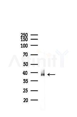 TDP43 Recombinant Rabbit mAb - Western blot analysis of lysates from Mouse heart, using TDP43 Recombinant Rabbit mAb at 1/1000 dilution.